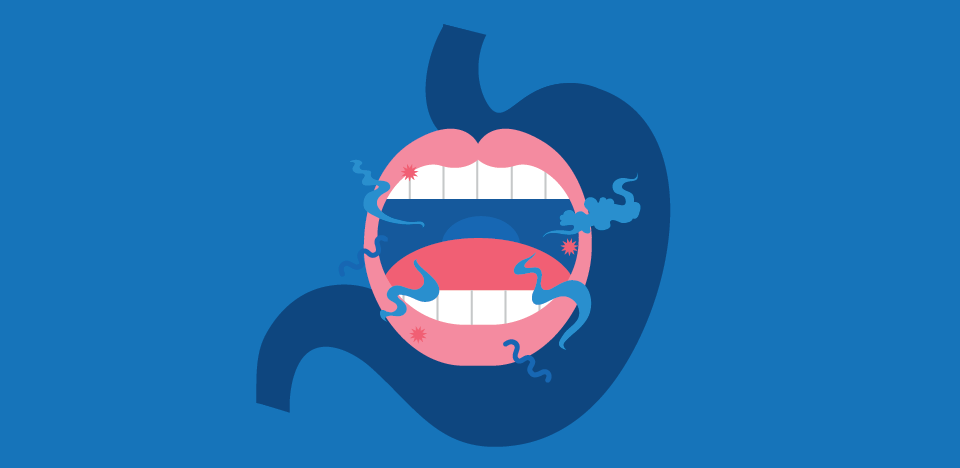 mau-halito-yogateria5